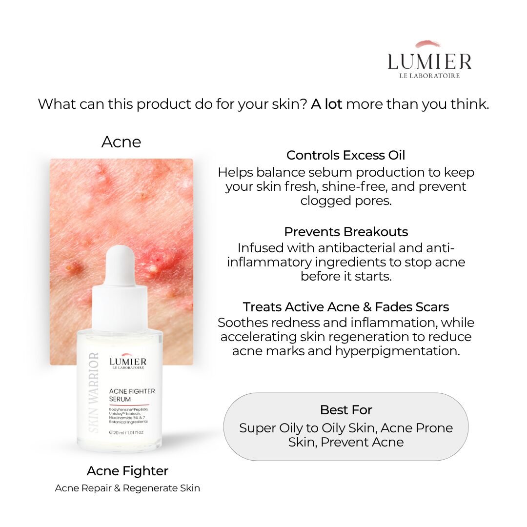 Skin Warrior Acne Fighter Serum - 20ml - Image 2