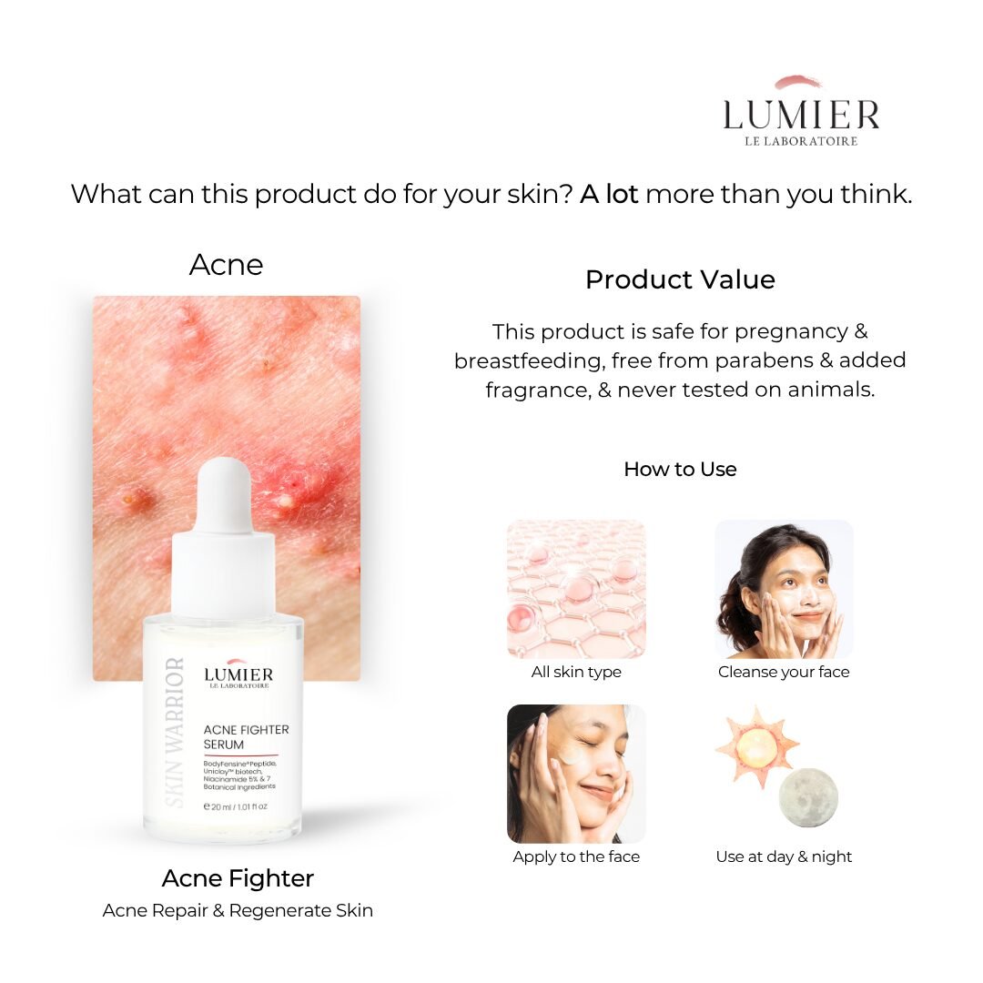 Skin Warrior Acne Fighter Serum - 20ml - Image 3