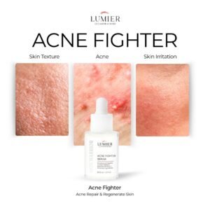 Skin Warrior Acne Fighter Serum - 20ml