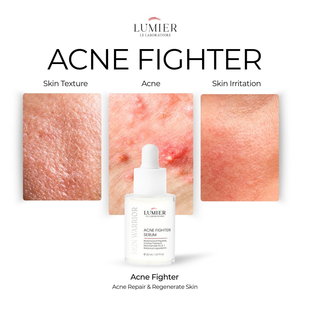 Skin Warrior Acne Fighter Serum - 20ml
