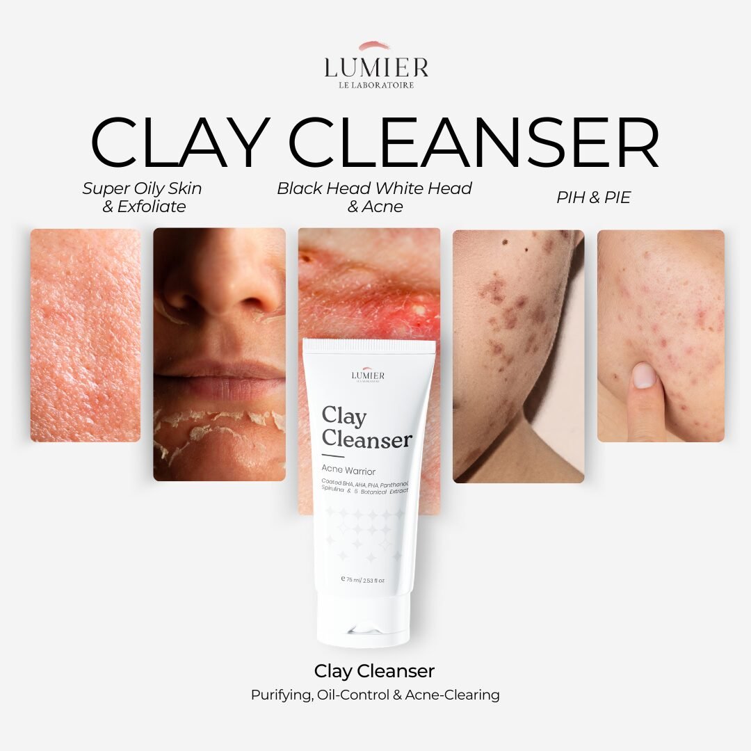Clay Cleanser - Acne Warrior